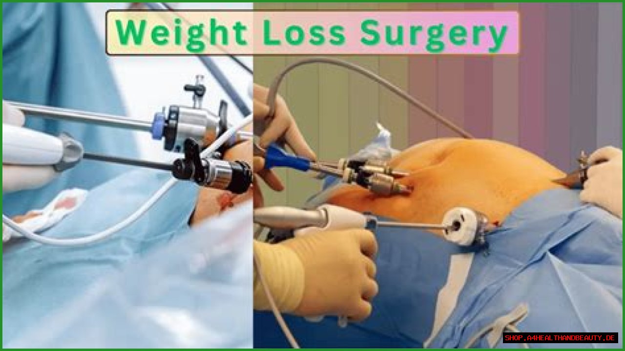 Discoveries Before Weight Loss Surgery