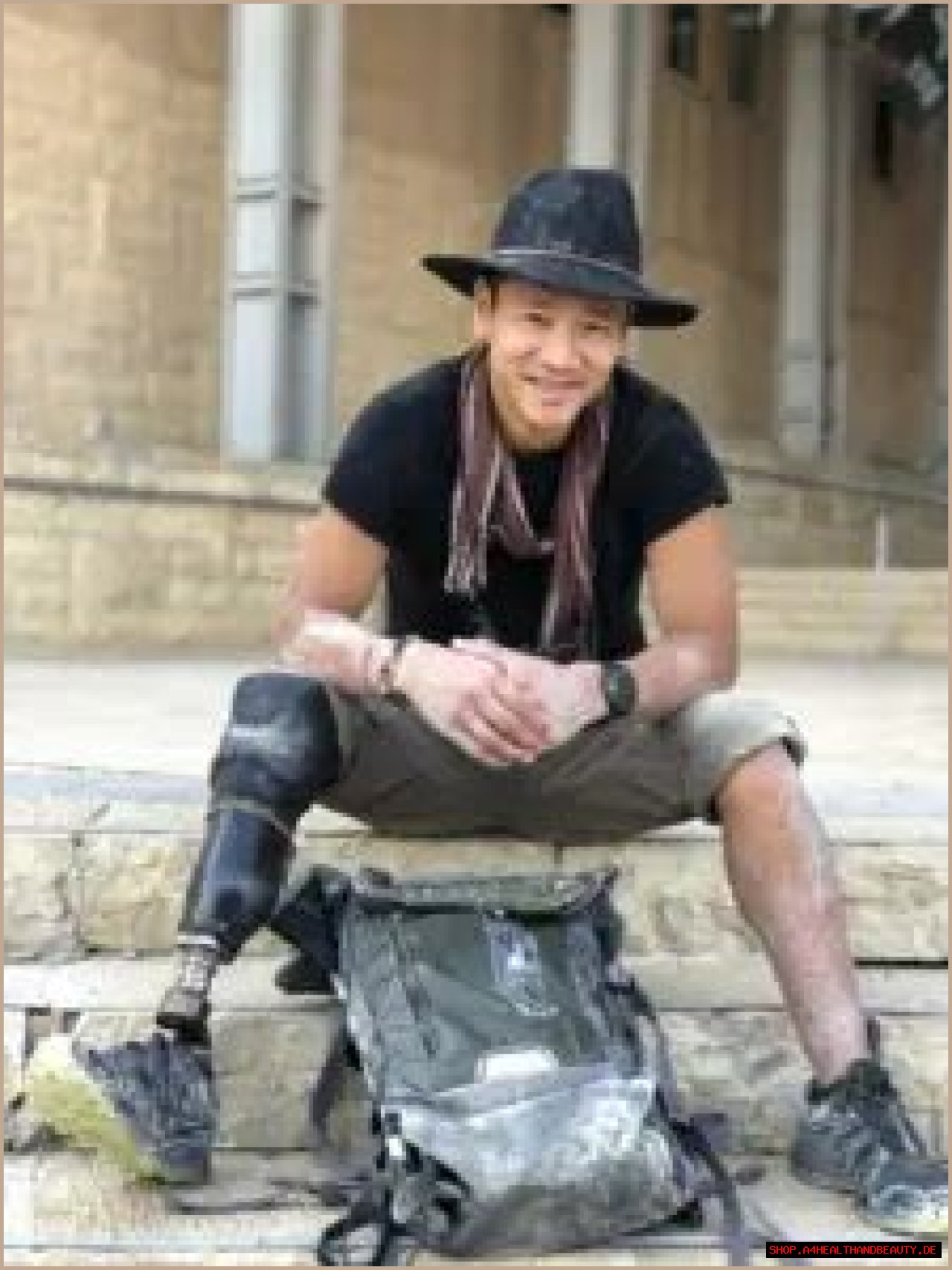 How Did Albert Lin Lose His Leg?